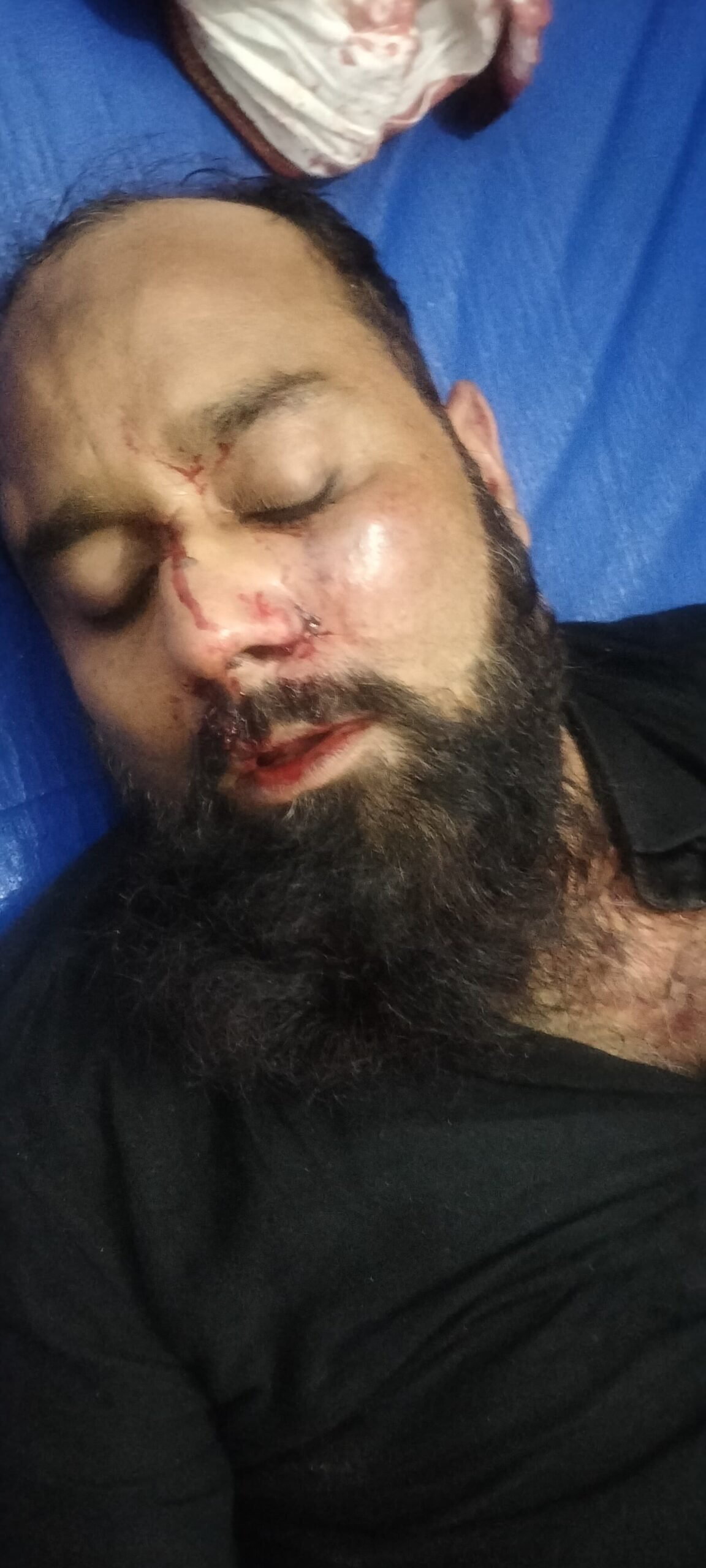 : ग्राम प्रधान के विजयी जुलूस में बवाल, लाठीचार्ज में कई घायल